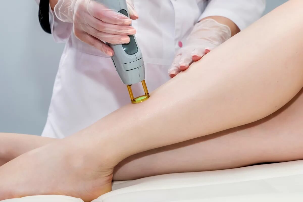 Waxing and laser hair removal